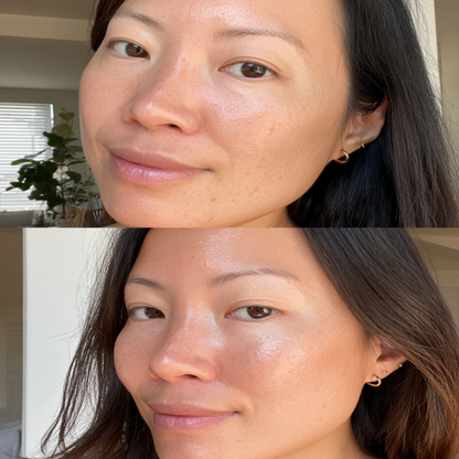 LED Light Therapy Mask Skin Care