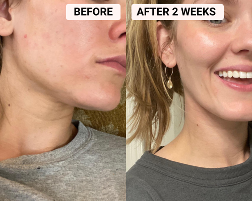 led-light-therapy-mask-skin-care